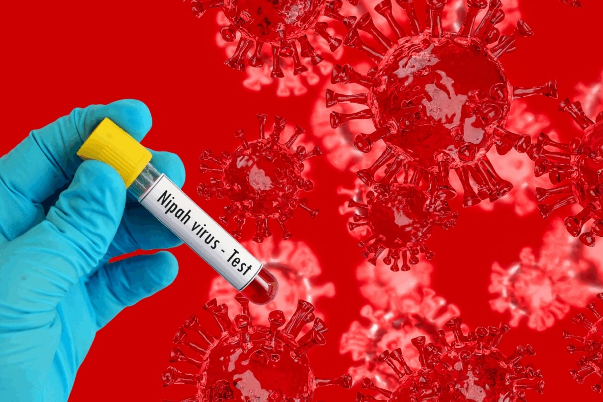 Nipah virus